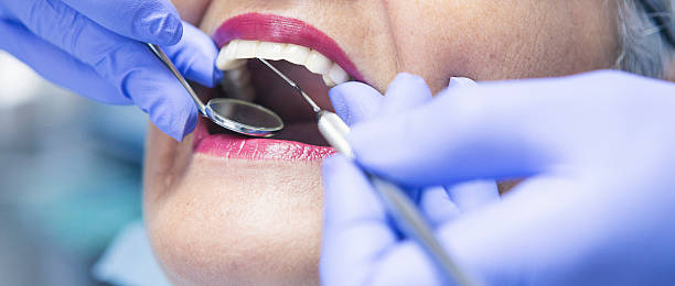 Best Emergency Treatment for Dental Infections or Abscesses in Charlotte, MI